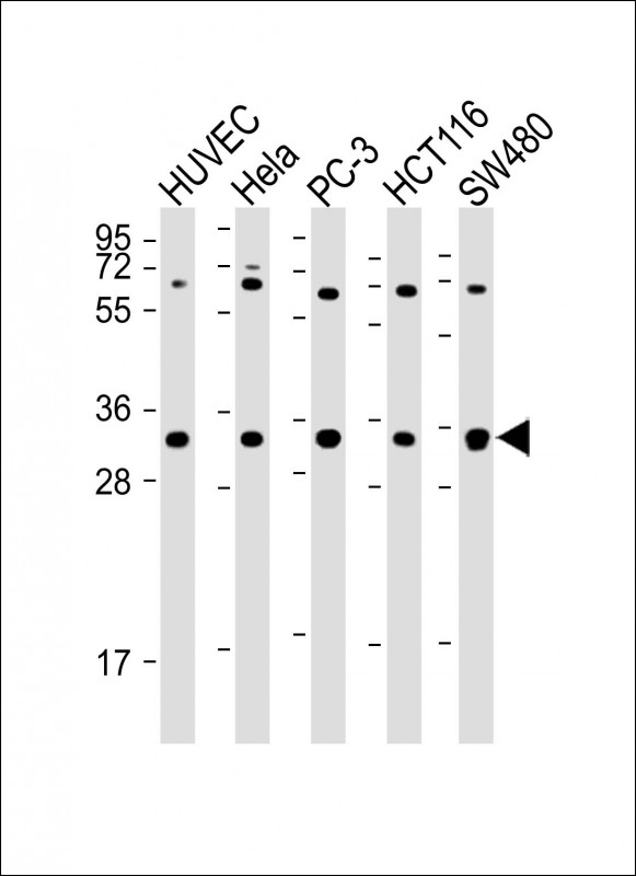 Rabbit Polyclonal Antibody to TNFRSF6B (N-term)