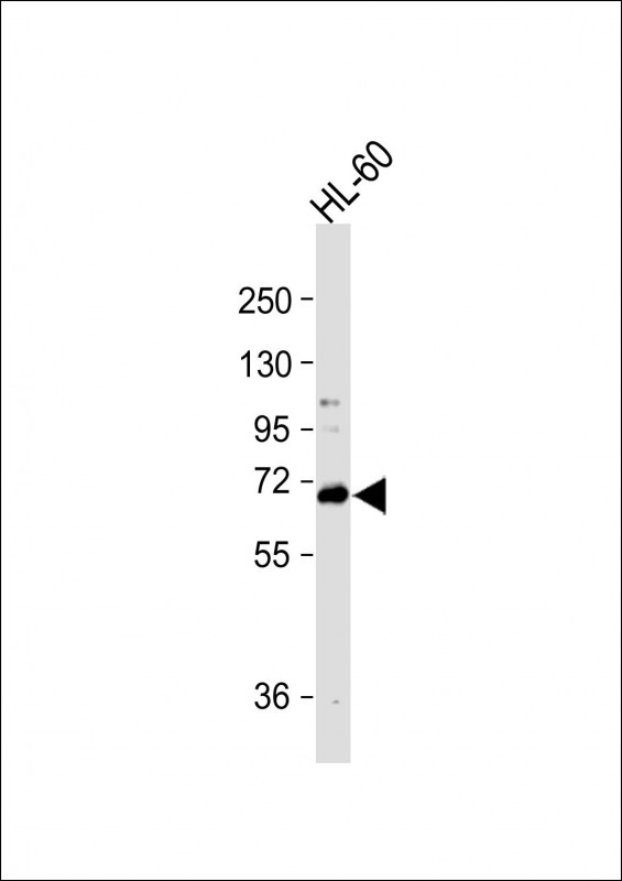 Rabbit Polyclonal Antibody to WDR70