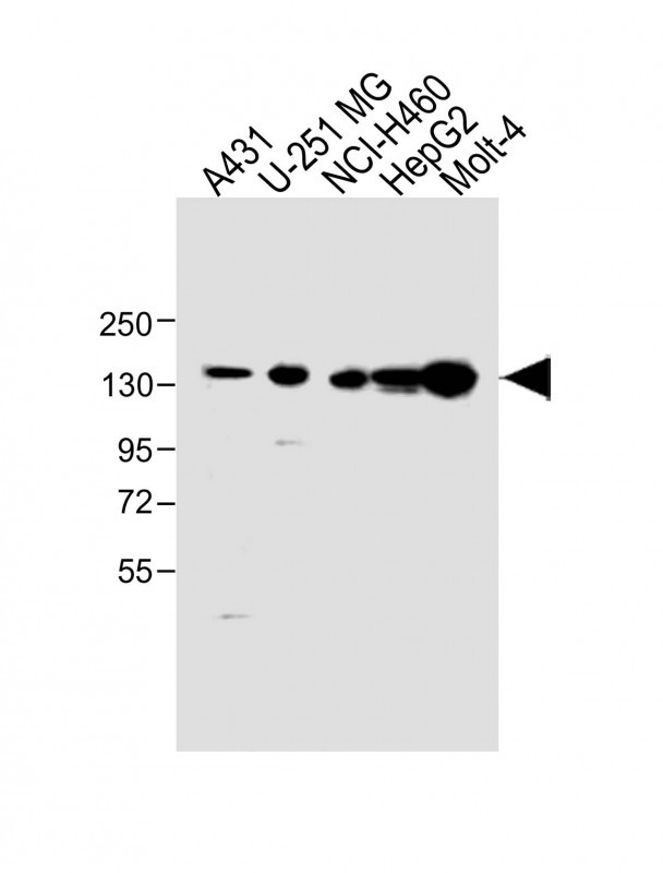 Rabbit Polyclonal Antibody to XIRP1