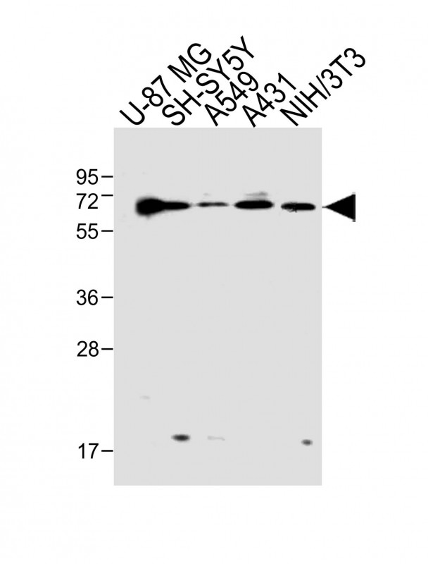 Rabbit Polyclonal Antibody to Epsin2 (N-term)