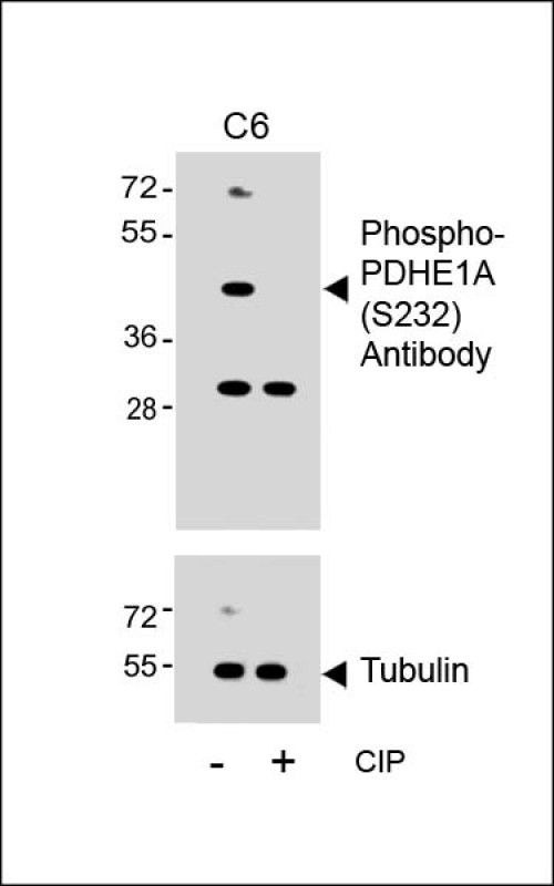 Rabbit Polyclonal Antibody to Phospho-PDHE1A(S232)