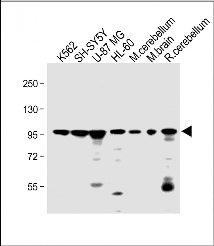 Rabbit Polyclonal Antibody to DNAJC6