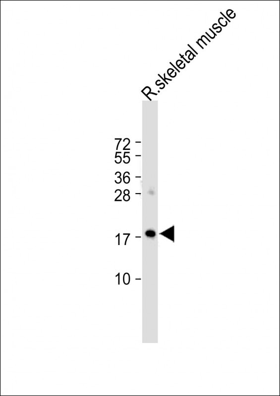 Rabbit Polyclonal Antibody to ORMDL3