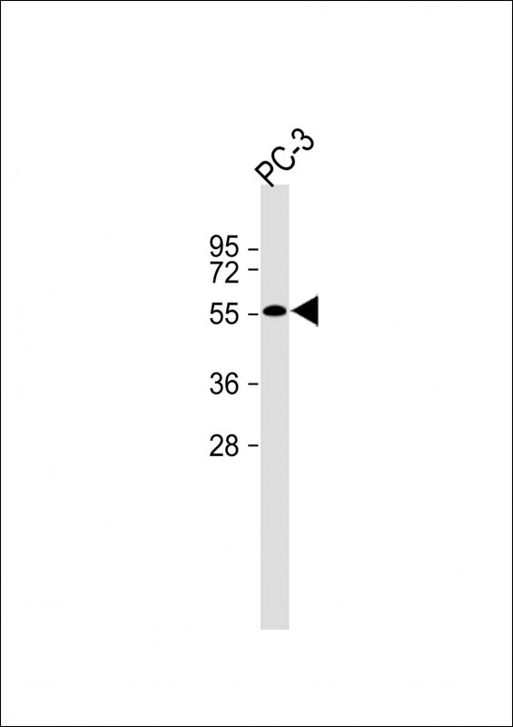 Rabbit Polyclonal Antibody to LARP6  (N-term)