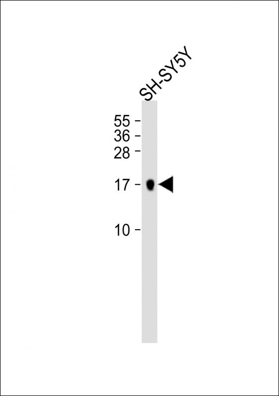 Rabbit Polyclonal Antibody to PLA2G2D
