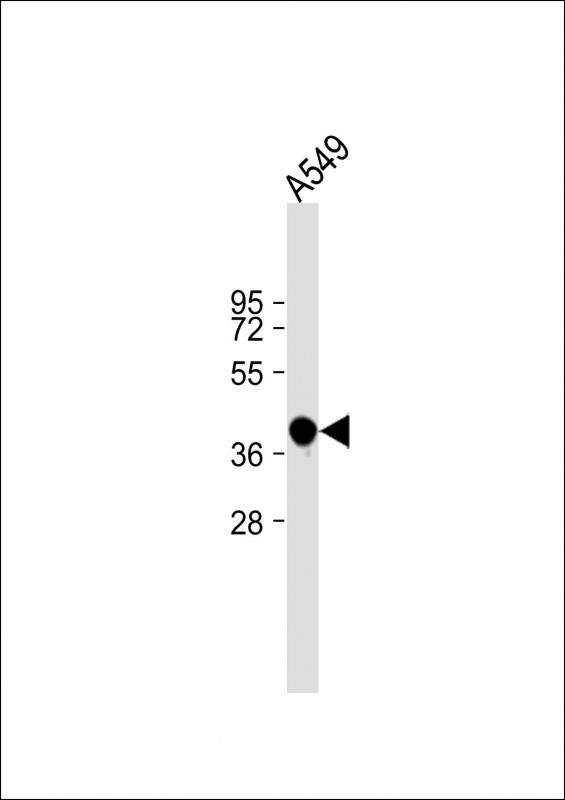 Rabbit Polyclonal Antibody to CACNG8 (N-term)