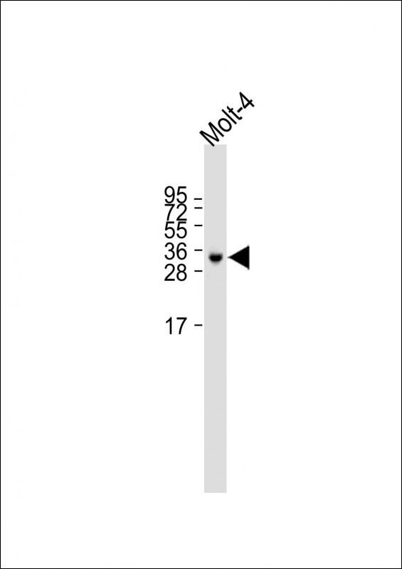 Rabbit Polyclonal Antibody to TRBC1