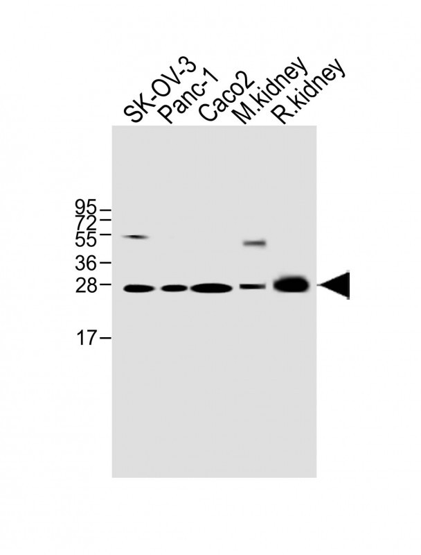 Rabbit Polyclonal Antibody to TMEM97 (N-term)