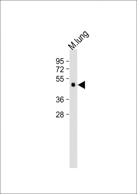 Rabbit Polyclonal Antibody to DPEP2
