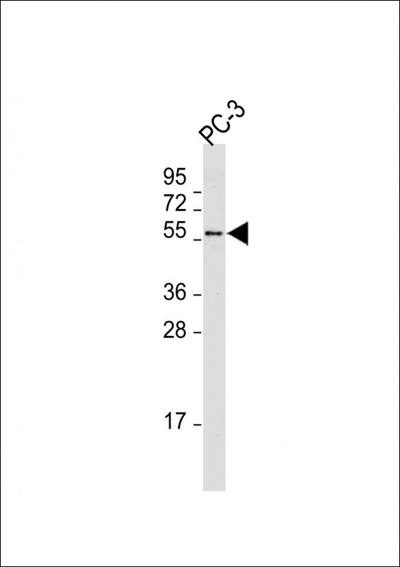 Rabbit Polyclonal Antibody to MKRN3