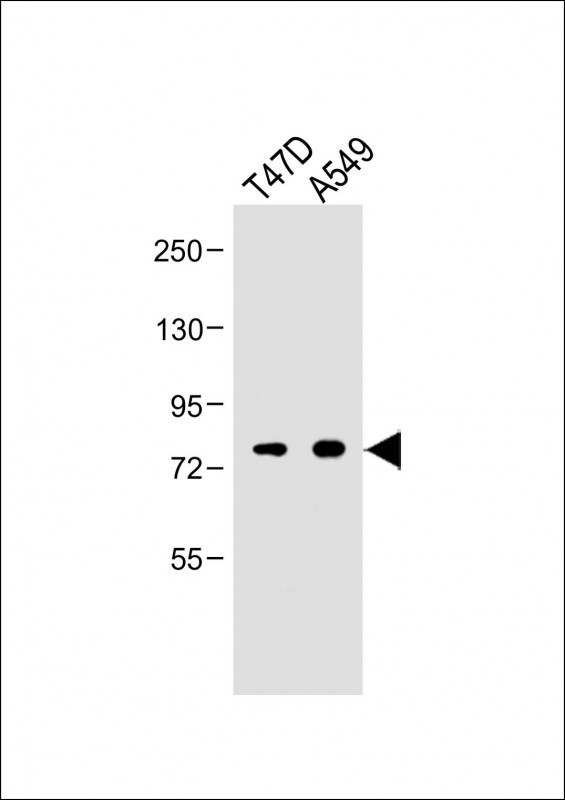 Rabbit Polyclonal Antibody to EXT2