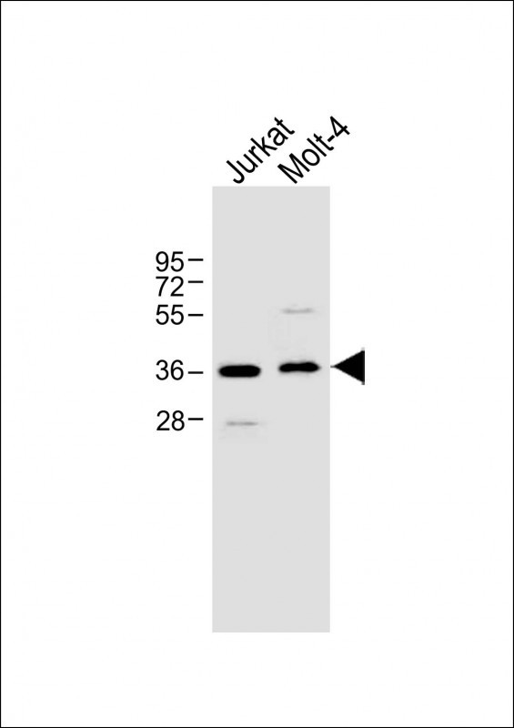 Rabbit Polyclonal Antibody to CB2