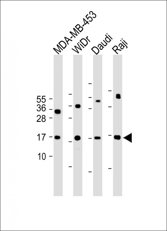 Rabbit Polyclonal Antibody to M4A4A  (N-term)