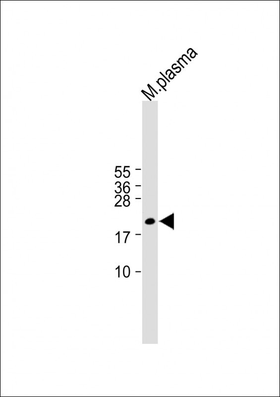 Rabbit Polyclonal Antibody to GPX3
