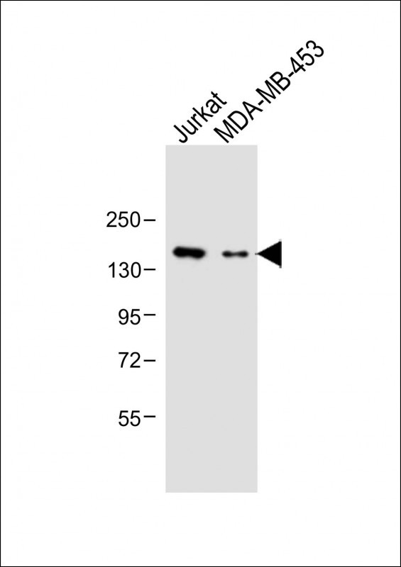 Rabbit Polyclonal Antibody to GRIN2A