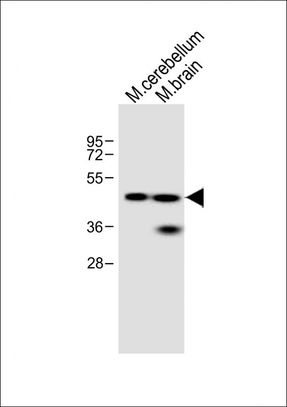 Rabbit Polyclonal Antibody to Evx2 (N-term)