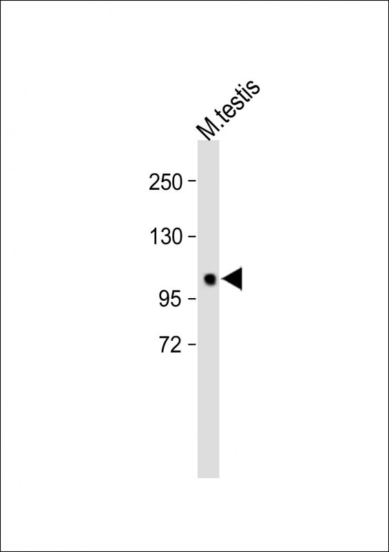 Rabbit Polyclonal Antibody to POLN