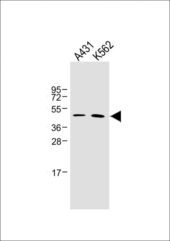 Rabbit Polyclonal Antibody to ZDHHC6