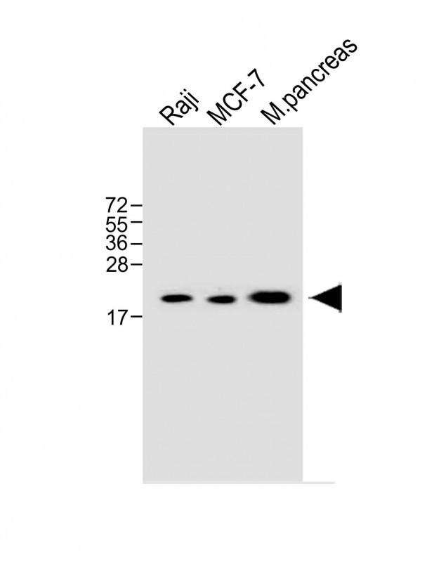 Rabbit Polyclonal Antibody to RPL12