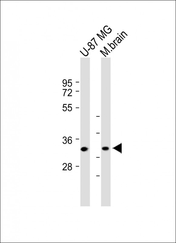 Rabbit Polyclonal Antibody to TMEM158