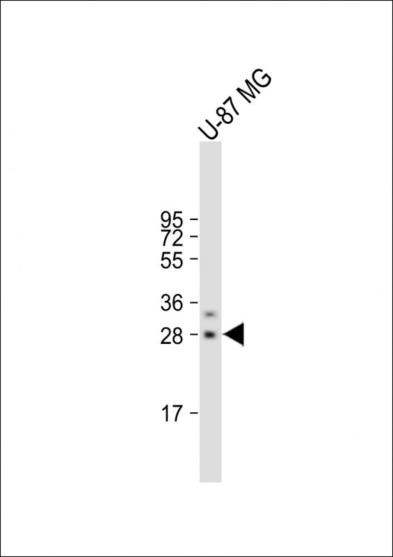 Rabbit Polyclonal Antibody to RSPO2
