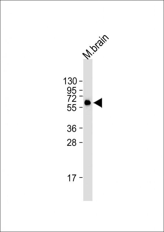 Rabbit Polyclonal Antibody to HAS2