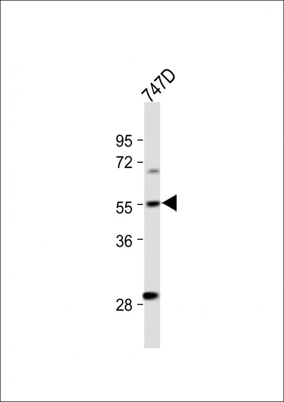Rabbit Polyclonal Antibody to CYP27B1
