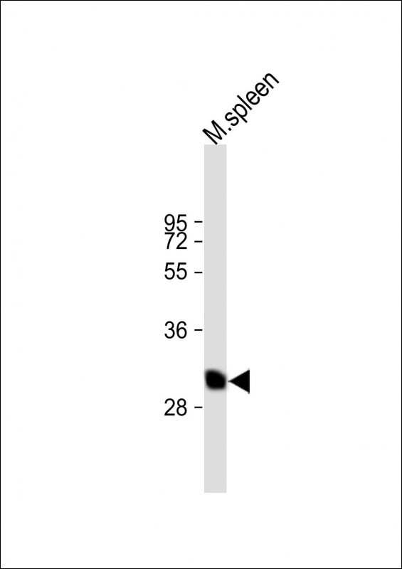 Rabbit Polyclonal Antibody to BSND
