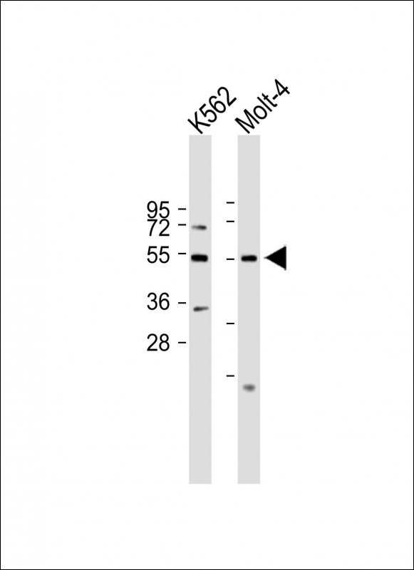 Rabbit Polyclonal Antibody to B7H6