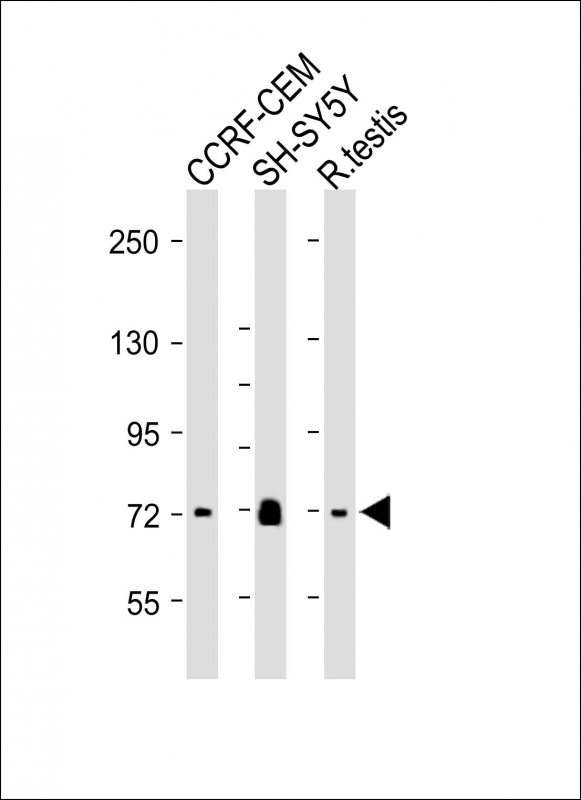 Rabbit Polyclonal Antibody to NALD2