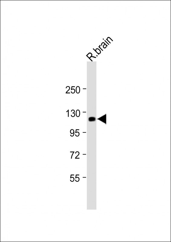 Rabbit Polyclonal Antibody to LGR5 (N-term)