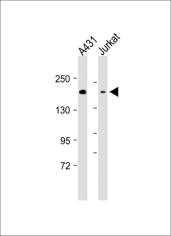 Rabbit Polyclonal Antibody to ABCB11
