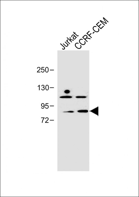 Rabbit Polyclonal Antibody to PLK2 (SNK)