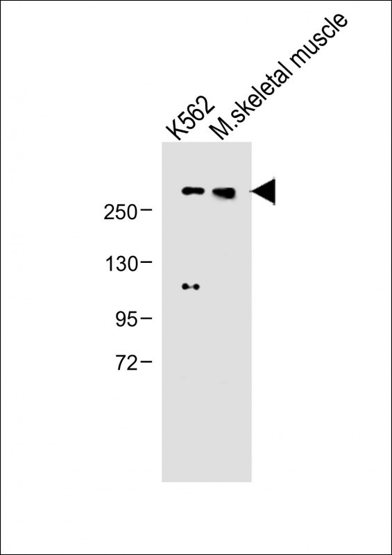 Rabbit Polyclonal Antibody to ADAMTS13