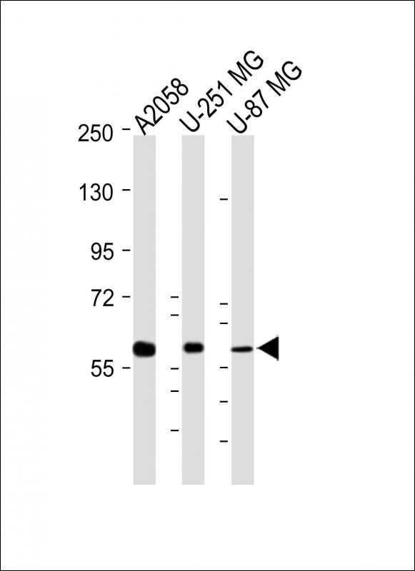 Mouse Monoclonal Antibody to MMP14