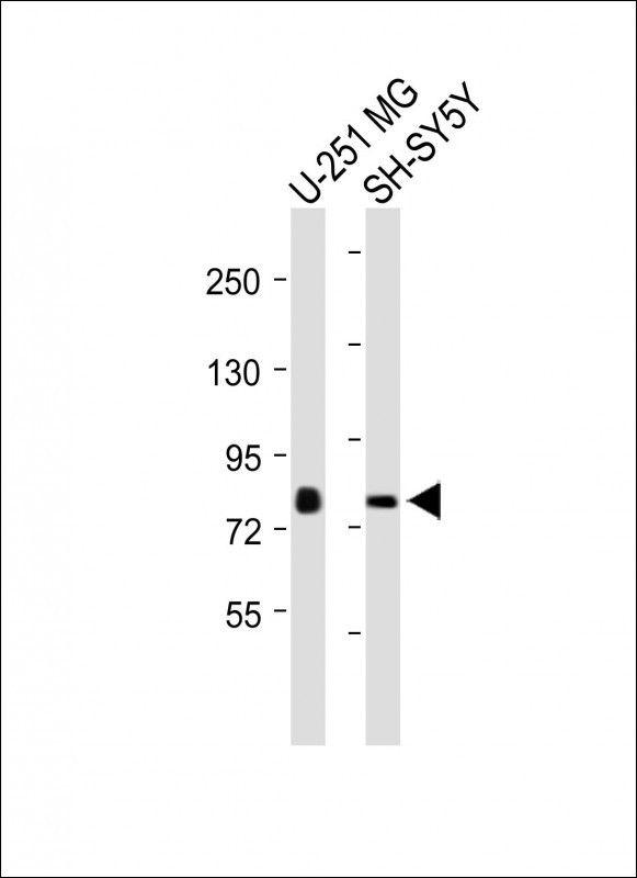 Rabbit Polyclonal Antibody to NSUN7