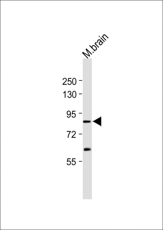 Rabbit Polyclonal Antibody to C11orf63