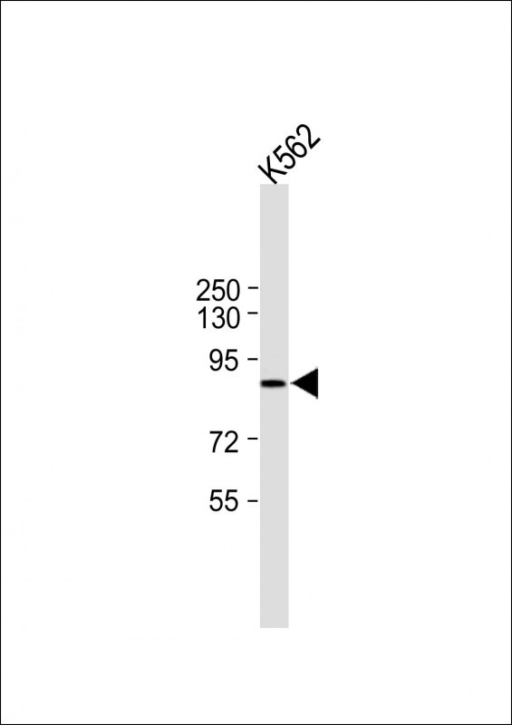 Rabbit Polyclonal Antibody to HHIPL2