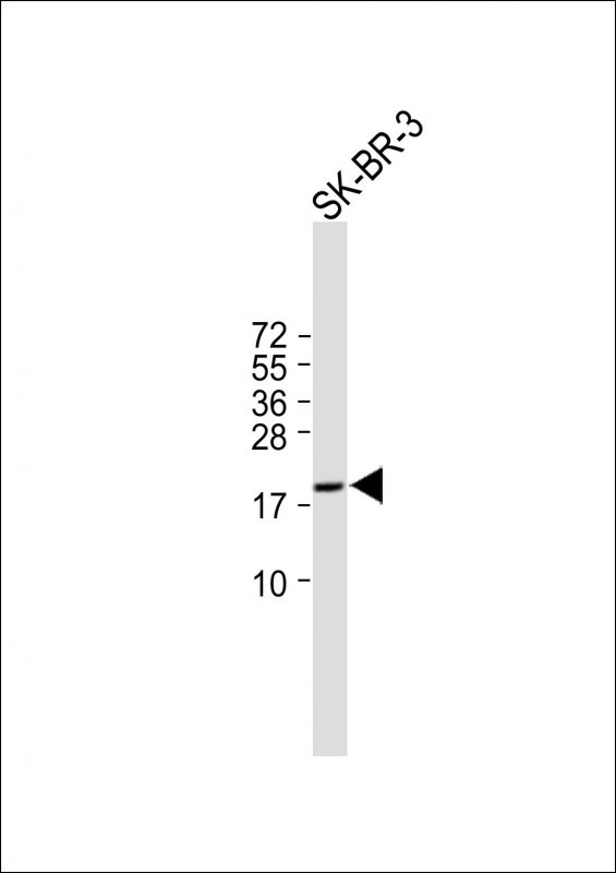 Rabbit Polyclonal Antibody to C4orf39