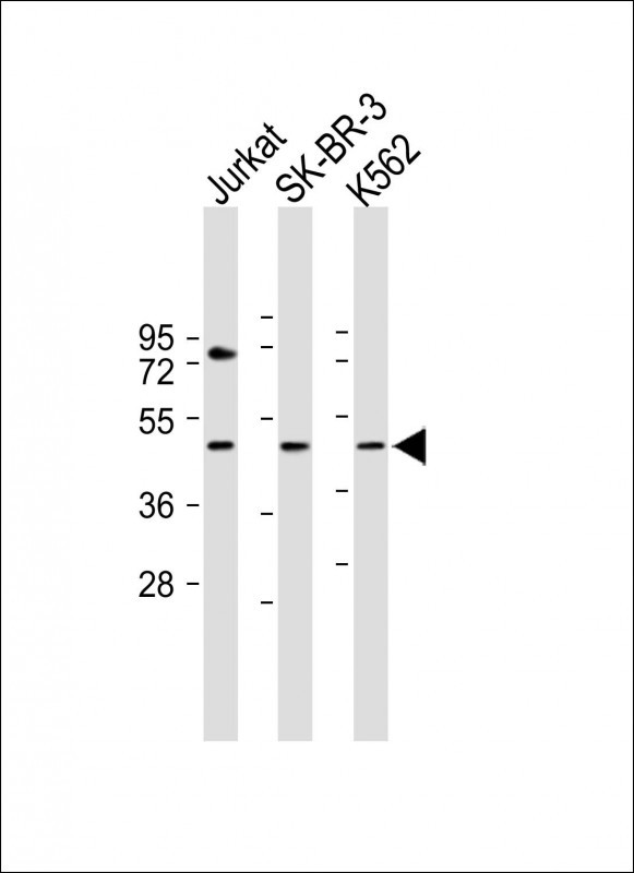 Rabbit Polyclonal Antibody to LOC441476
