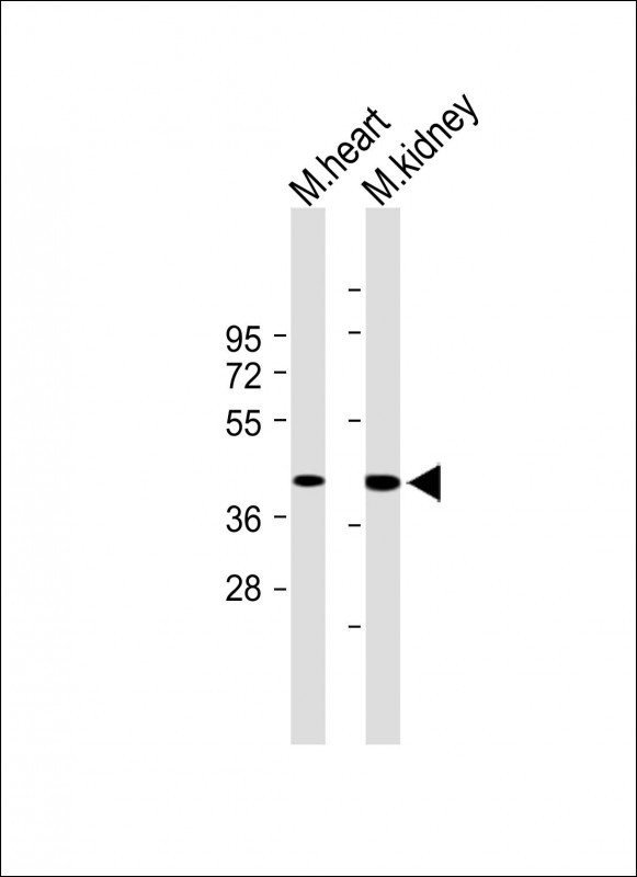 Rabbit Polyclonal Antibody to TMEM120A (N-term)