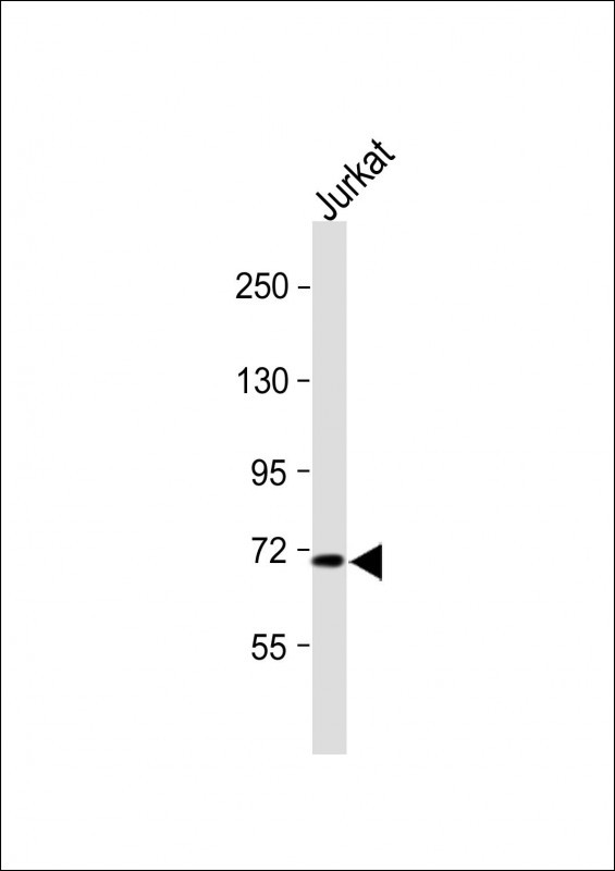 Rabbit Polyclonal Antibody to SLC9A6