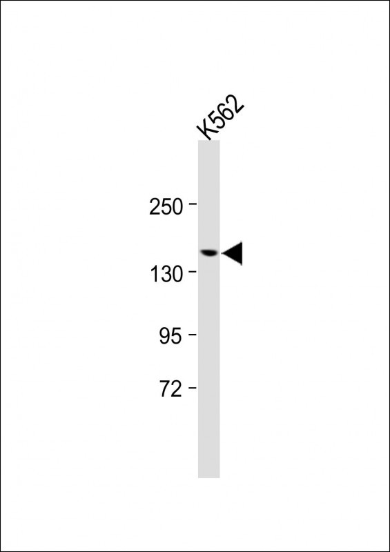 Rabbit Polyclonal Antibody to UBN2 (N-term)