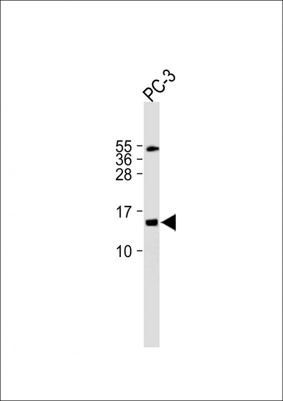 Rabbit Polyclonal Antibody to FUNDC2