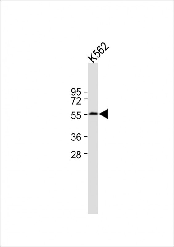 Rabbit Polyclonal Antibody to PHF21B