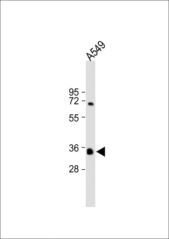 Rabbit Polyclonal Antibody to KCNK7