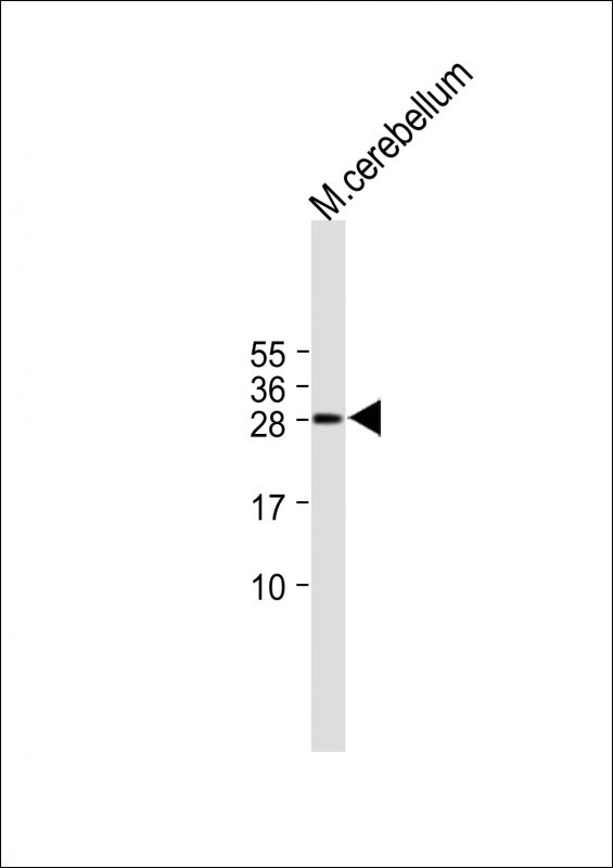 Rabbit Polyclonal Antibody to RIMS4 (N-term)