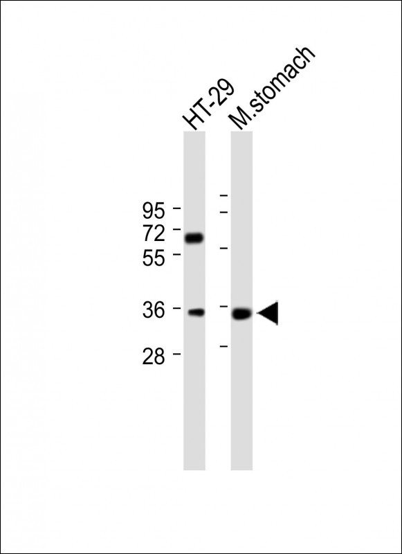 Rabbit Polyclonal Antibody to KLF6