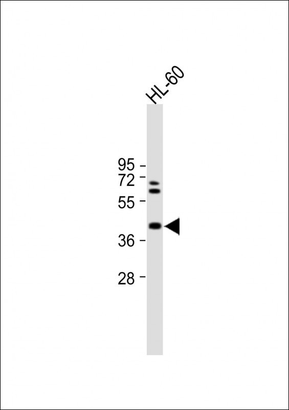 Rabbit Polyclonal Antibody to MVD