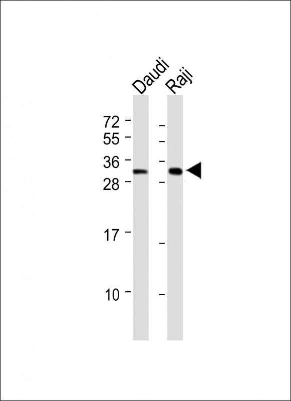 Rabbit Polyclonal Antibody to HLA-DRA (N-term)